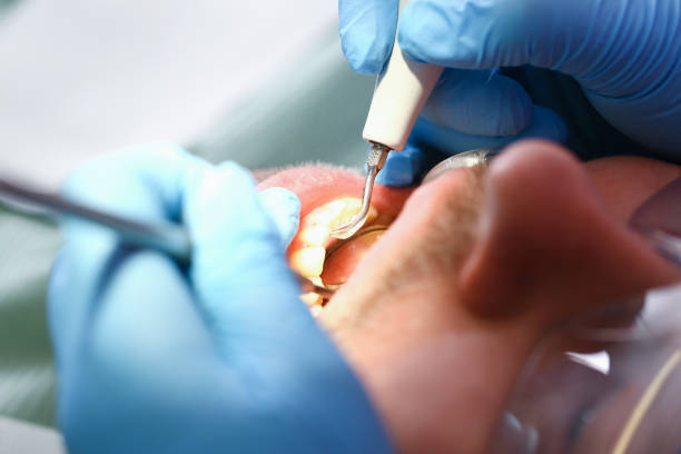 Best Mobile Emergency Dentist in Malibu, CA
